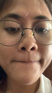 Jerawat nongol